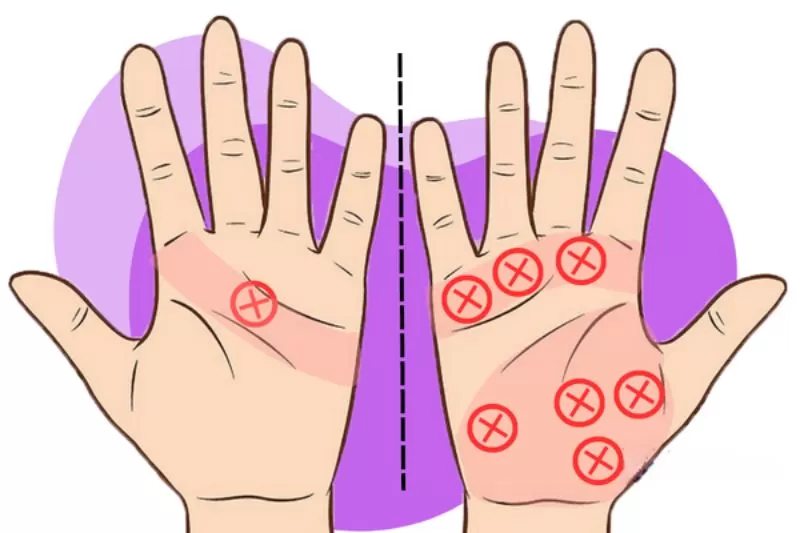 Đường chỉ tay chữ X