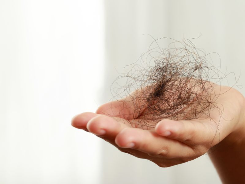 Nằm mơ thấy vuốt tóc rụng 3