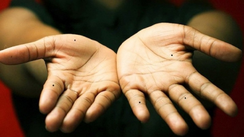 Nốt ruồi ở lòng bàn tay nữ và nam giới có ý nghĩa gì?