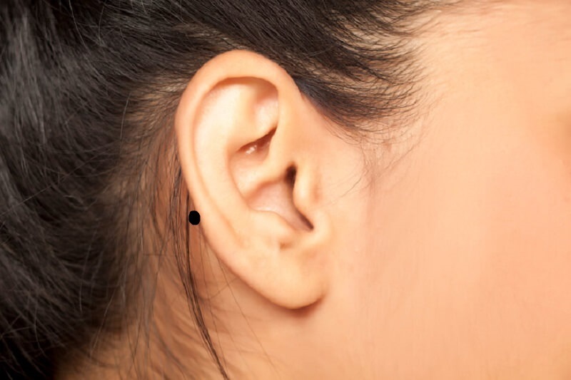 Nốt ruồi sau tai phải tai trái phụ nữ, nam giới ý nghĩa gì?